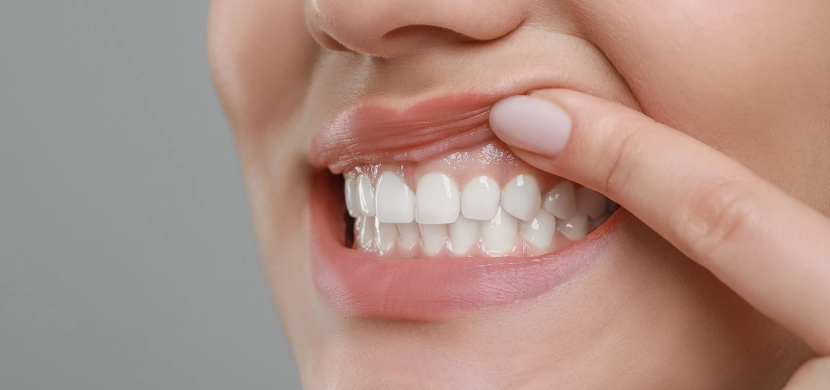 soins gencives La parodontite : la maladie des gencives Dr Pierre Mioche - Dentiste à Clermont-Ferrand