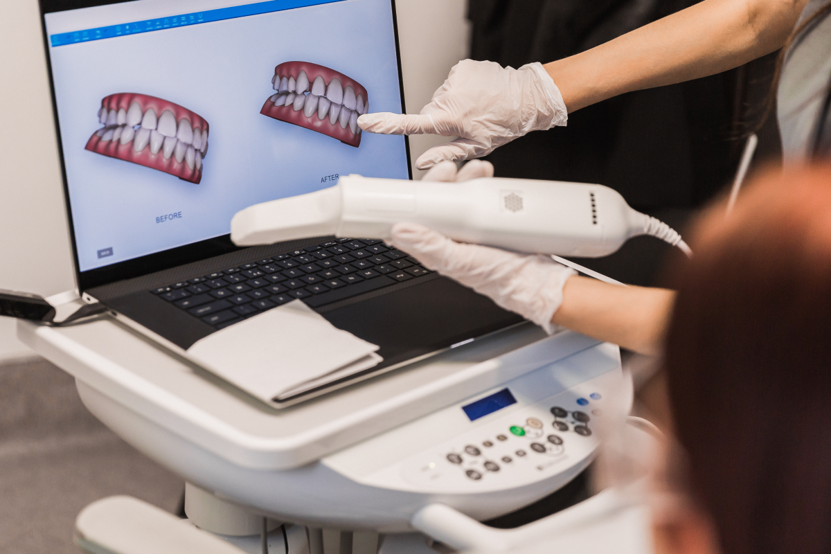 empreinte numerique dentaire